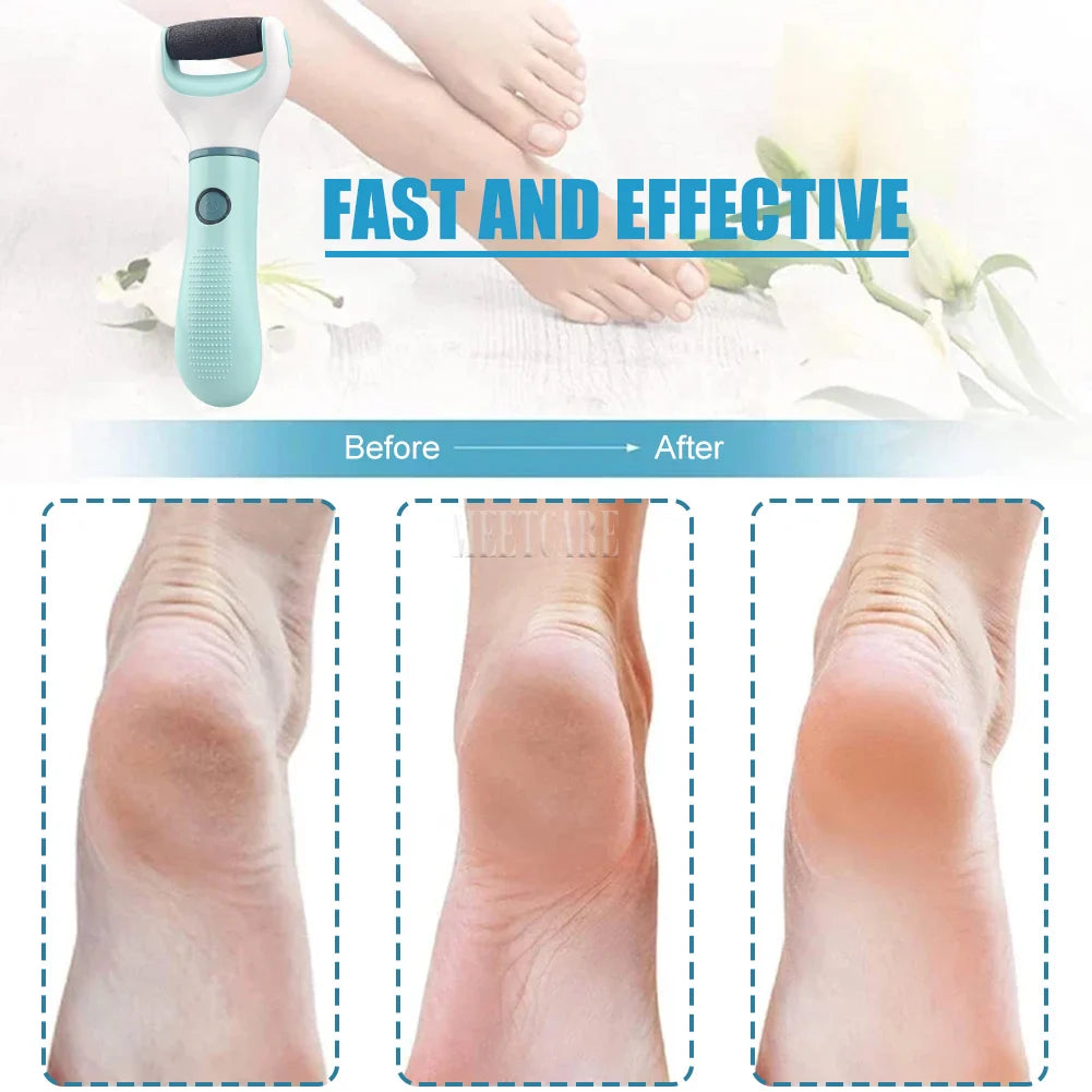 Electric Foot Grinder Wireless Pedicure Tool – Waterproof Callus & Dead Skin Remover